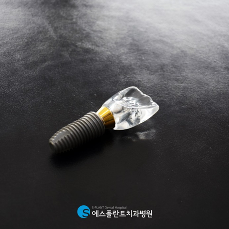 Post-Implant Surgery Precautions and Care Tips from a Dental Clinic Known for Good Implant Treatment image 2
