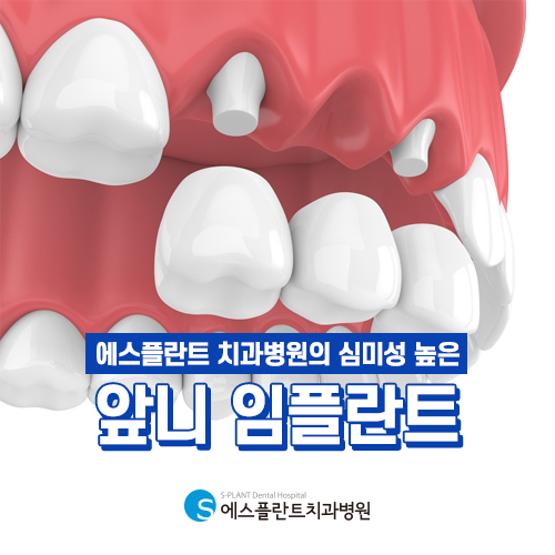 앞니 임플란트 진행 시 고려해야할 사항 [에스플란트 치과병원] 관련 이미지 5