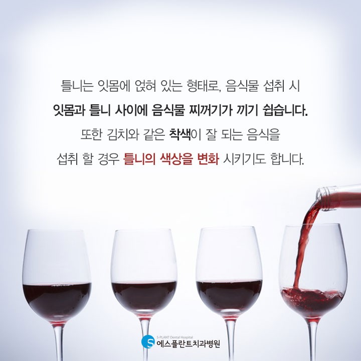 틀니, 잘못 관리하면 구강 문제를 일으킬 수 있습니다. 관련 이미지 3