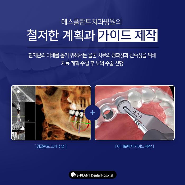임플란트도 염증이? 임플란트 주위염이란 관련 이미지 5