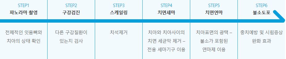 만성치주염 환자를 위한 에스플란트 치과병원의 맞춤관리 관련 이미지 8