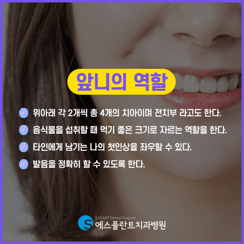 환한 미소를 지켜드리는 에스플란트 치과병원의 앞니 임플란트 관련 이미지 2