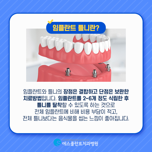 에스플란트의 &lsquo;임플란트틀니&rsquo; 두 가지의 장점을 결합했습니다. 관련 이미지 4