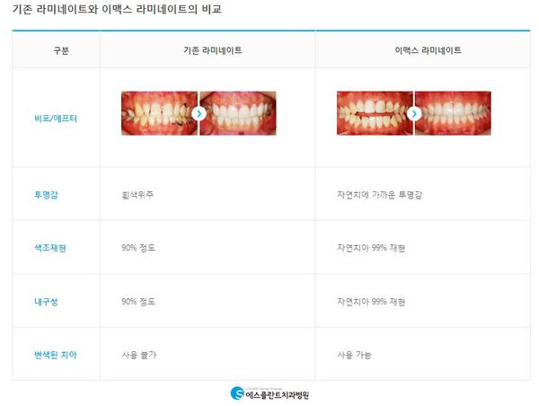 누런치아,손상줄이고하얗게만드는방법 관련 이미지 5