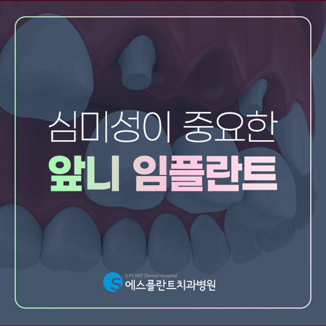 첫인상을 좌우하는 앞니를 상실했다면? 앞니 임플란트 하세요! 관련 이미지 1