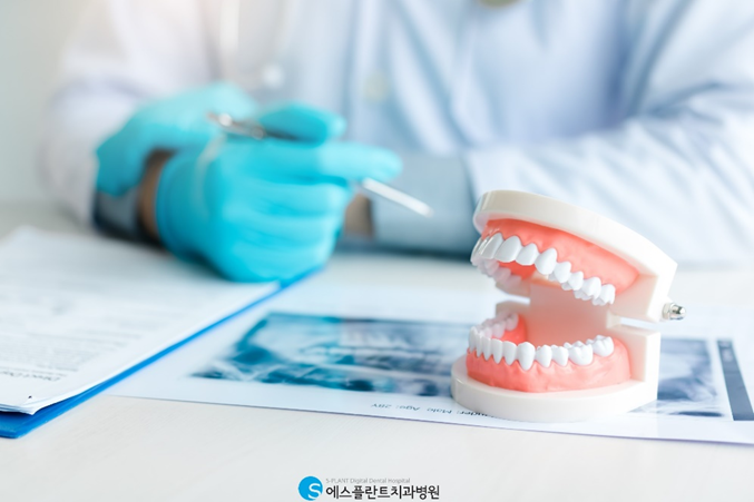 어금니임플란트를 통해 치아건강을 지키세요. 관련 이미지 5