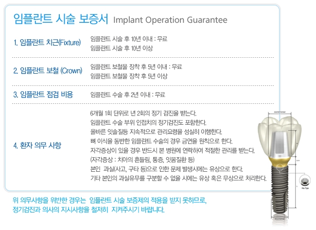 [임플란트관리법]임플란트 수명, 임플란트 사후관리 관련 이미지 7