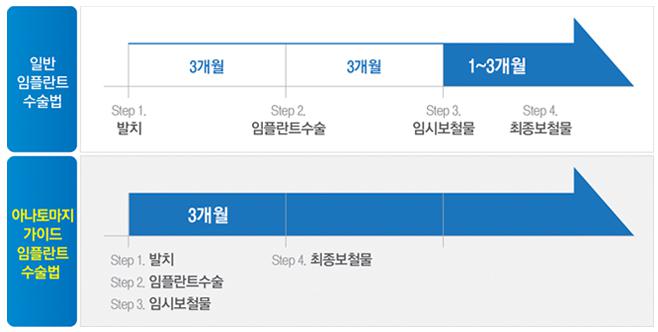 [당일임플란트/임플란트과정]강남임플란트잘하는곳,디지털화된즉시 기능임플란트! 관련 이미지 5