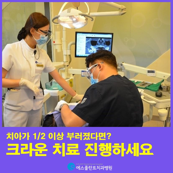 치아가 1/2 이상 부러졌다면? 크라운 치료 진행하세요. 관련 이미지 1