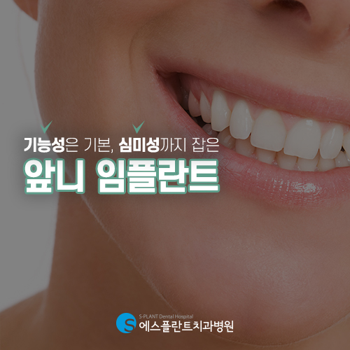 심미성과 기능성을 모두 잡는 에스플란트의 앞니 임플란트 관련 이미지 3