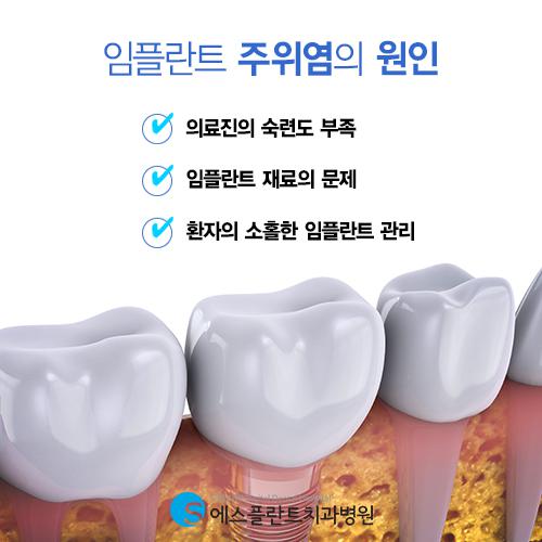 임플란트주위염 미리 예방하는 방법 없을까요? – 에스플란트치과병원 관련 이미지 3