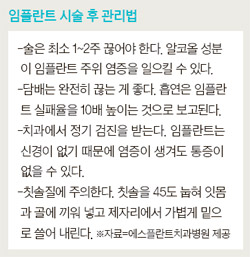 임플란트, 3D CT 가상수술 후 잇몸 최소 절개로 합병증 줄여 관련 이미지 3