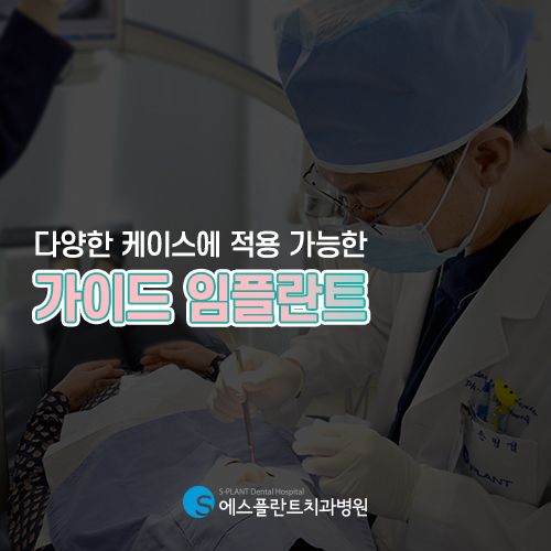 오차없는 임플란트 식립, 에스플란트의 가이드 임플란트 관련 이미지 3