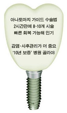 이젠 임플란트도 3D! 관련 이미지 8