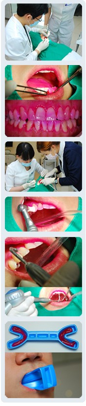 [흡연과 치아건강] 담배는 멀리, 칫솔은 가까이! 흡연자 구강관리 프로 그램 관련 이미지 3