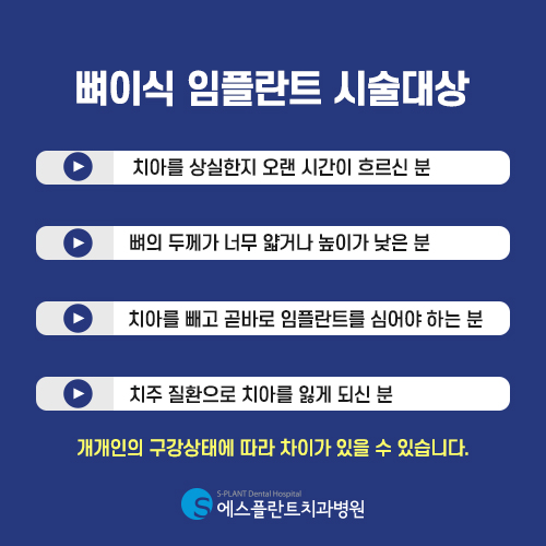 뼈이식 임플란트, 에스플란트의 충분한 상담을 통해 안전하게 진행 관련 이미지 6