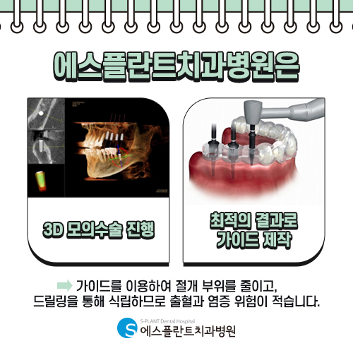 당뇨와 같은 만성질환 환자, 임플란트 어렵나요? [에스플란트 치과병원] 관련 이미지 5