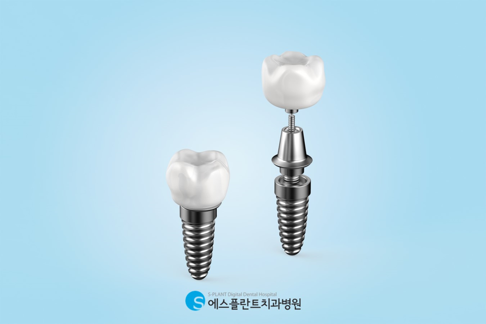 Gangnam Apgujeong Implant Reoperation: Important Precautions You Must Know image 2