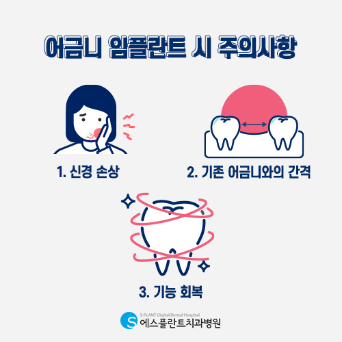 튼튼한 어금니 임플란트로 맛있는 음식 맘껏 드세요! [에스플란트 치과병원] 관련 이미지 6