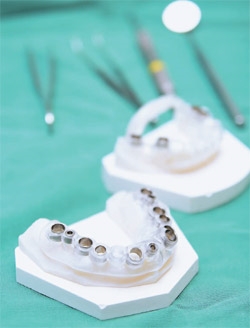 임플란트, 3D CT 가상수술 후 잇몸 최소 절개로 합병증 줄여 관련 이미지 5