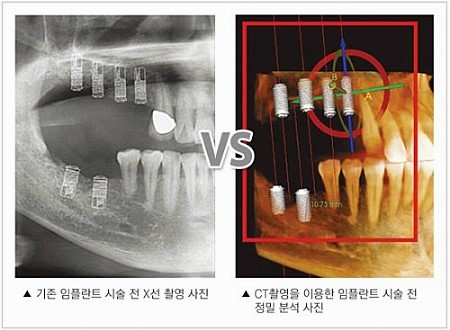 세계적으로 소개되는 관련 이미지 2