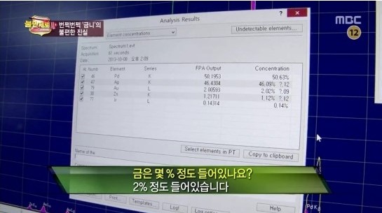 금니, 꼼꼼히 따져봐야 후회 없다 관련 이미지 3