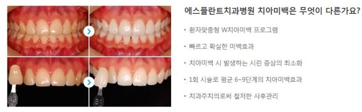 흡연이 치아에 미치는 영향 알려드릴게요. 관련 이미지 5