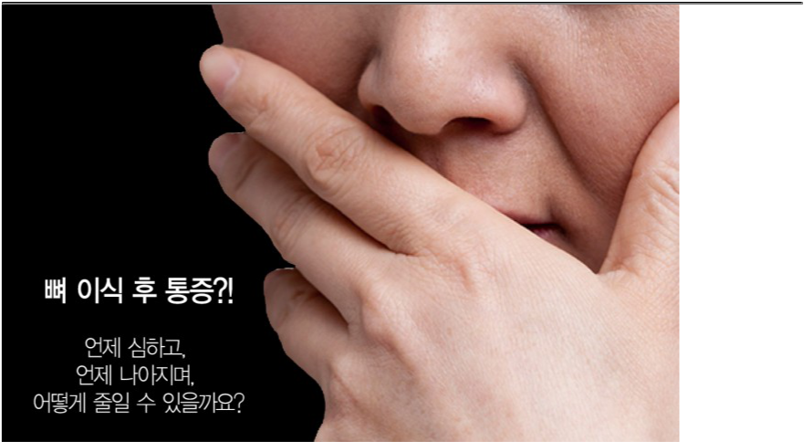 임플란트뼈이식통증,언제제일심한가요? 관련 이미지 2