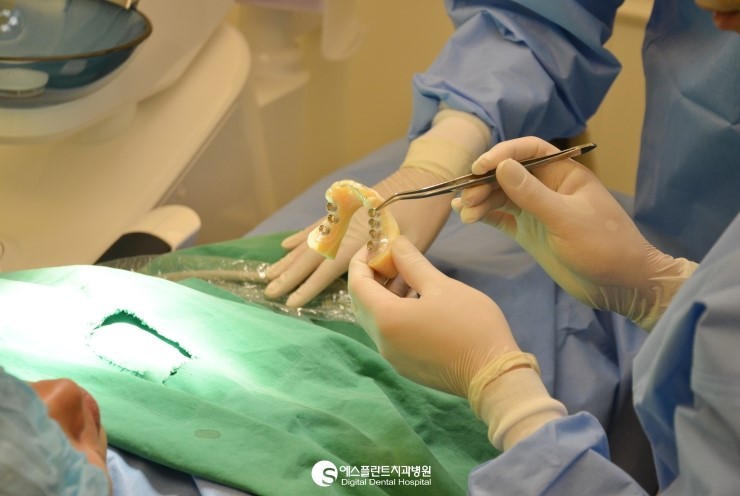 [즉시식립임플란트] 에스플란트치과병원 이정택 원장이 추천하는 즉시 식립 임플란트! 관련 이미지 6