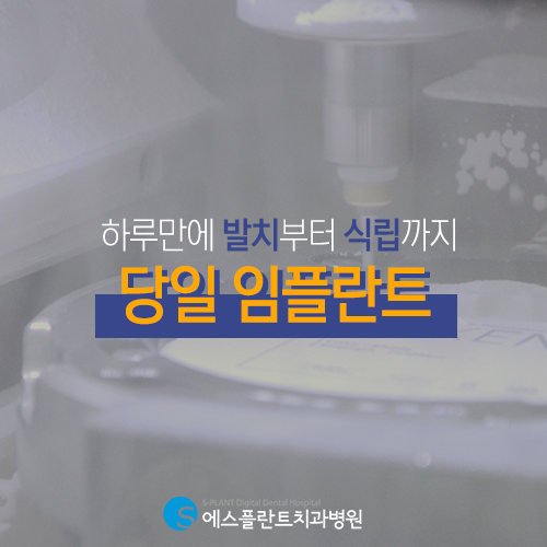임플란트도 이제는 당일에 가능, 에스플란트 치과병원의 당일 임플란트 관련 이미지 3