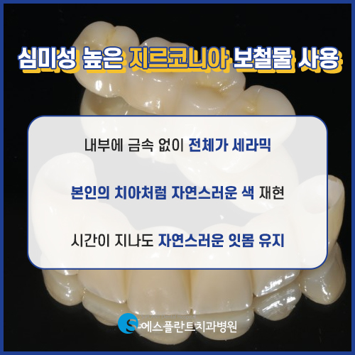 새해에는 더 밝게 웃자, 심미성 높은 앞니 임플란트 [에스플란트 치과병원] 관련 이미지 3