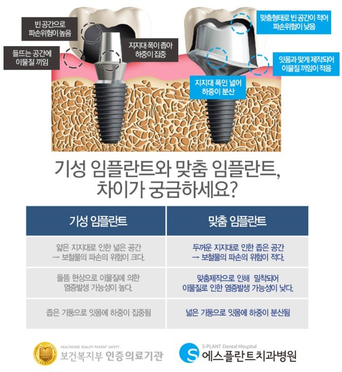 임플란트 재수술, 보다 신중하게 결정해야 하니까 에스플란트 치과병원 관련 이미지 8