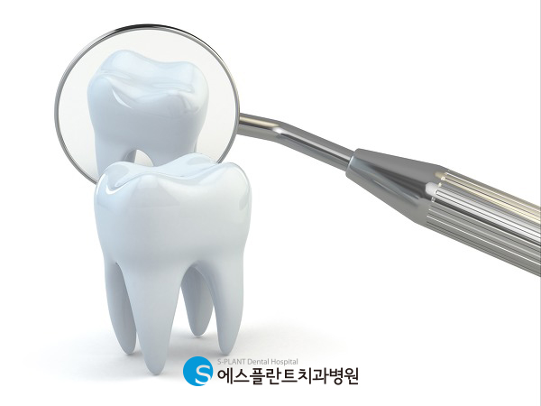 청담에서 임플란트 부작용 걱정 없이 수술받는 방법 관련 이미지 2