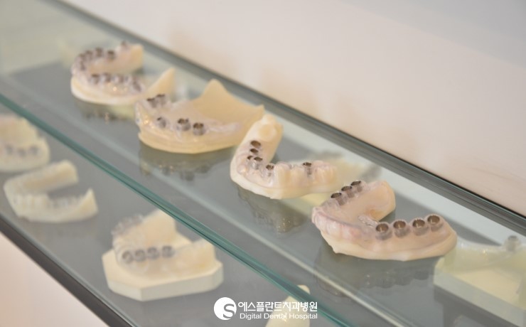 [즉시식립임플란트] 에스플란트치과병원 이정택 원장이 추천하는 즉시 식립 임플란트! 관련 이미지 3