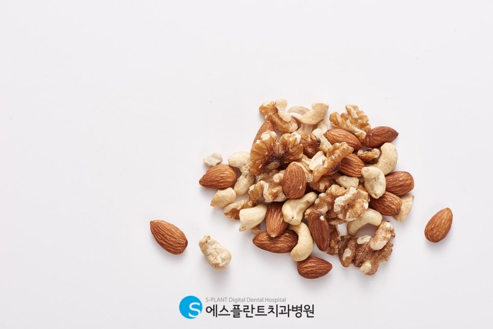 압구정 임플란트 치과, 임플란트 후 도움을 주는 영양소 3가지 관련 이미지 4