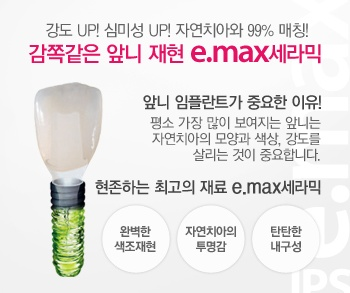 앞니임플란트 가격,앞니임플란트수술후두통있나요 관련 이미지 6