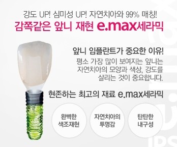[압구정로데오역 치과] 앞니 임플란트, 케이스별 맞춤 치료가 중요한 임 플란트! 관련 이미지 6