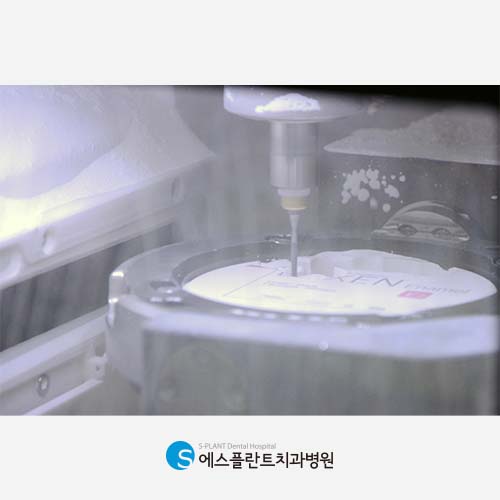 빠르고 정확한 보철물 제작을 위한 자체 기공실 [에스플란트 치과병원] 관련 이미지 4