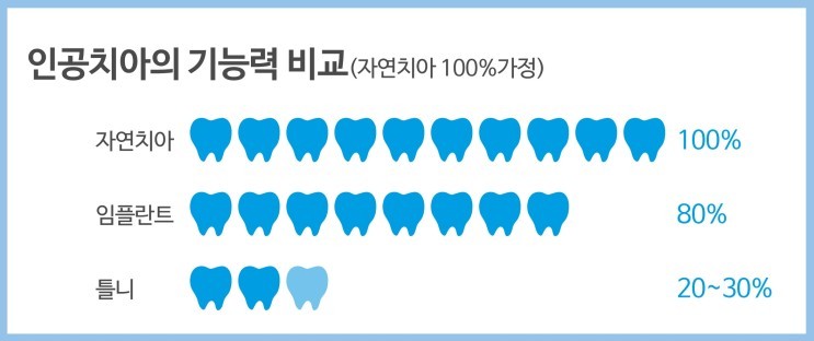 임플란트 시술시 중요포인트 꼭 확인하세요. 관련 이미지 3