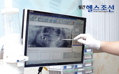 [임플란트주위염] 임플란트 심은 후 입내 심해졌다면?! 관련 이미지 2