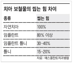 임플란트 브릿지, 임플란트 브릿지 비용 관련 이미지 5