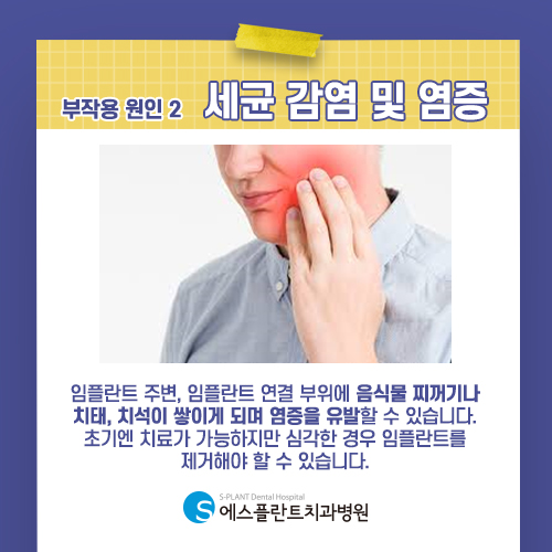 임플란트 부작용이 발생하는 이유, 재수술은 어떻게 진행될까 [에스플란트 치과병원] 관련 이미지 4