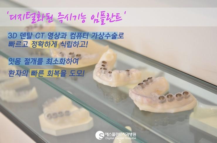 [당일임플란트/임플란트과정]강남임플란트잘하는곳,디지털화된즉시 기능임플란트! 관련 이미지 1