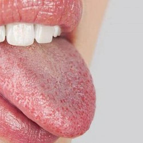 선생님 고혈압임플란트 가능할까요?? 관련 이미지 8