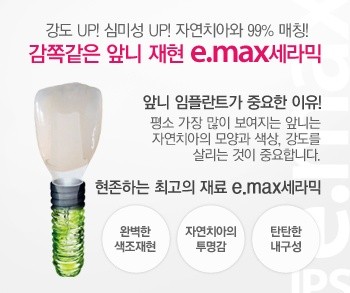 [앞니임플란트] 앞니 임플란트가격, 어금니 임플란트 가격 관련 이미지 3