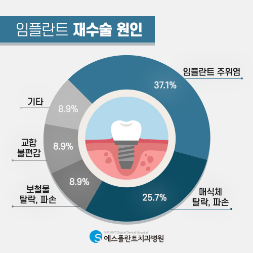 임플란트 재수술, 어떠한 경우에 필요할까요? [에스플란트 치과병원] 관련 이미지 5