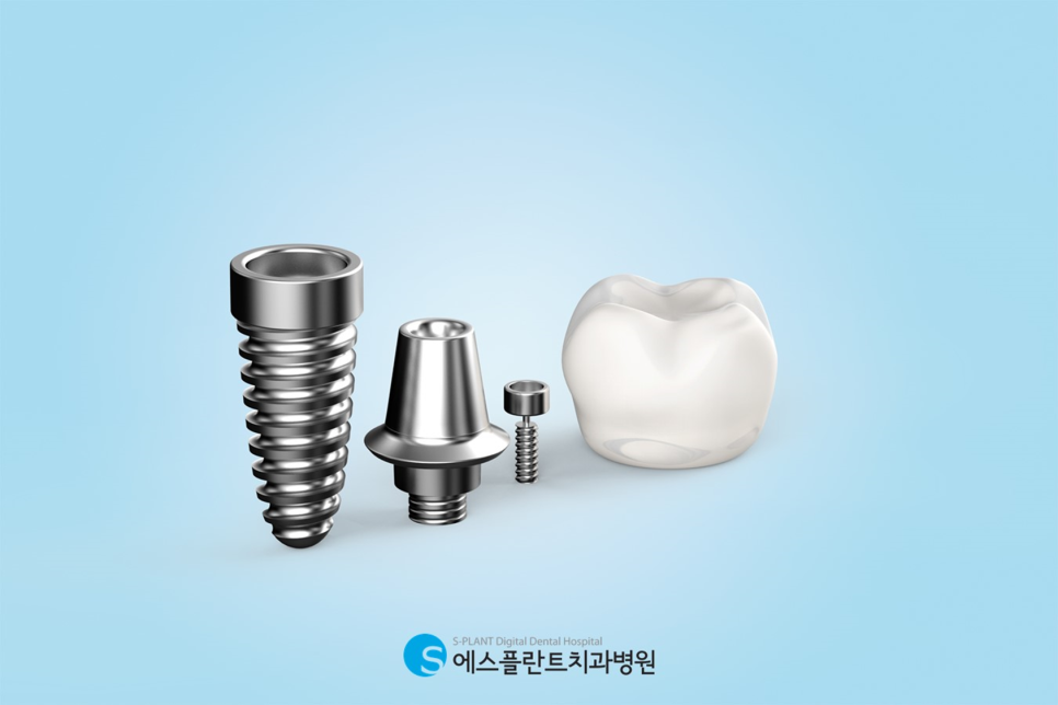 Apgujeong Dental Guide to the Success Rate of Implant Procedures and Maintenance Methods image 2