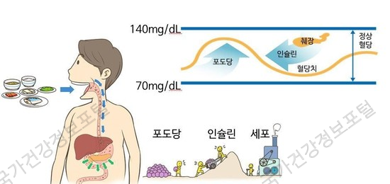 평생 관리가 필요한 당뇨, 그렇다고 임플란트 못할까? [에스플란트 치과병원] 관련 이미지 1