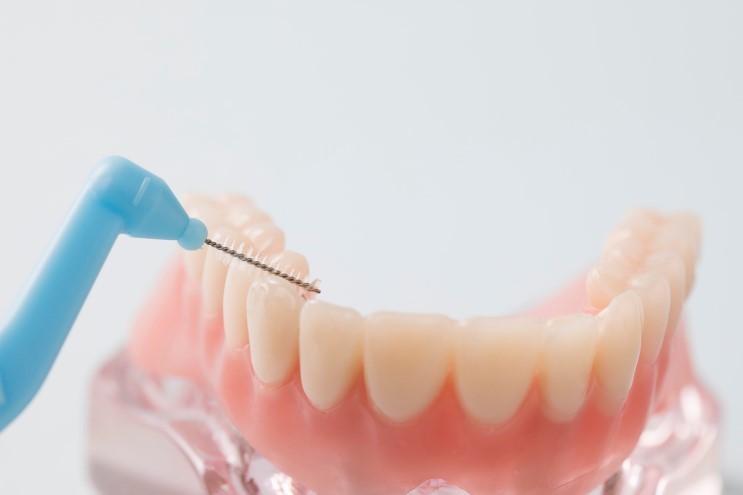 임플란트 심었다고 끝이 아닙니다! 에스플란트치과병원에서 전하는 임 플란트 주의사항 관련 이미지 4