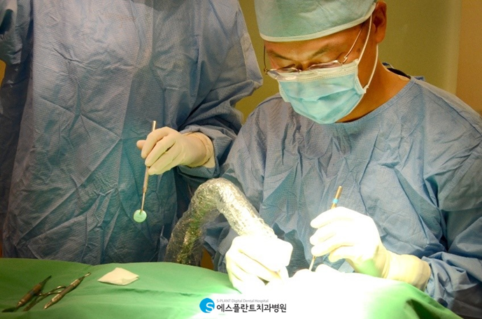 전악임플란트, 가이드를 이용해 수술시간은 줄이고, 정확성은 높이고! 관련 이미지 1